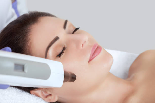 laser resurfacing